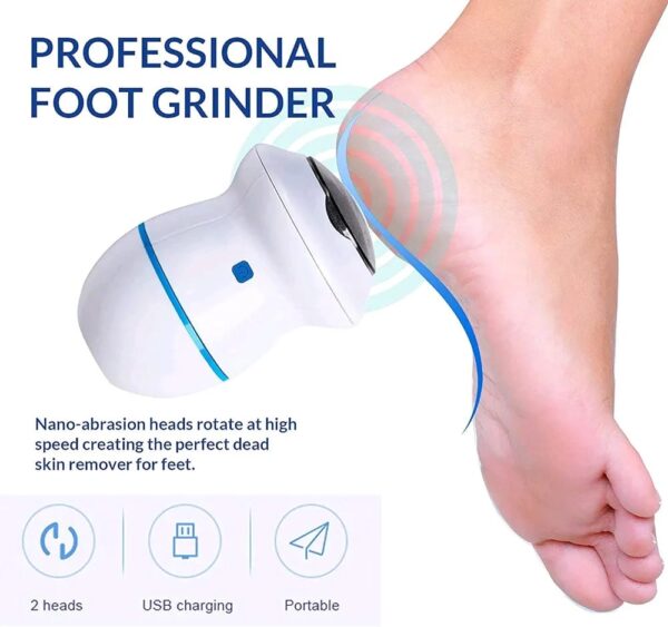 Callus remover 