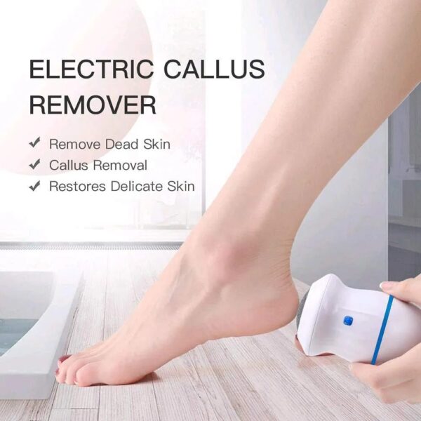 Callus remover 