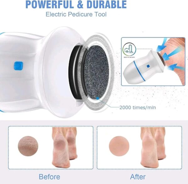 Callus remover 